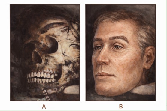 Two Dimensionsl facial reconstruction Max IAS